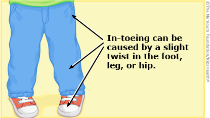 Shoes for pigeon toed adults clearance