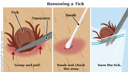 Getting a Tick off a Dog