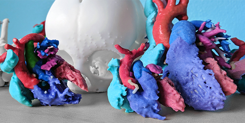 Series of 3D-printed models for cardiac and skeletal diseases