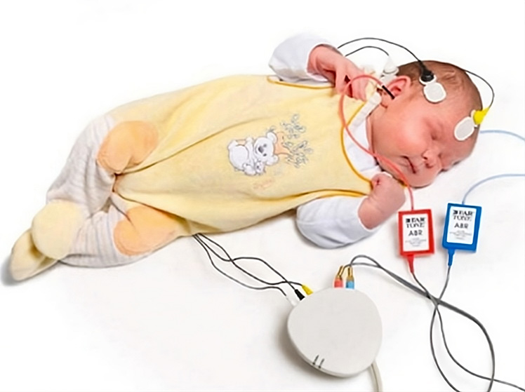 Cochlear-Implant-Patient-1