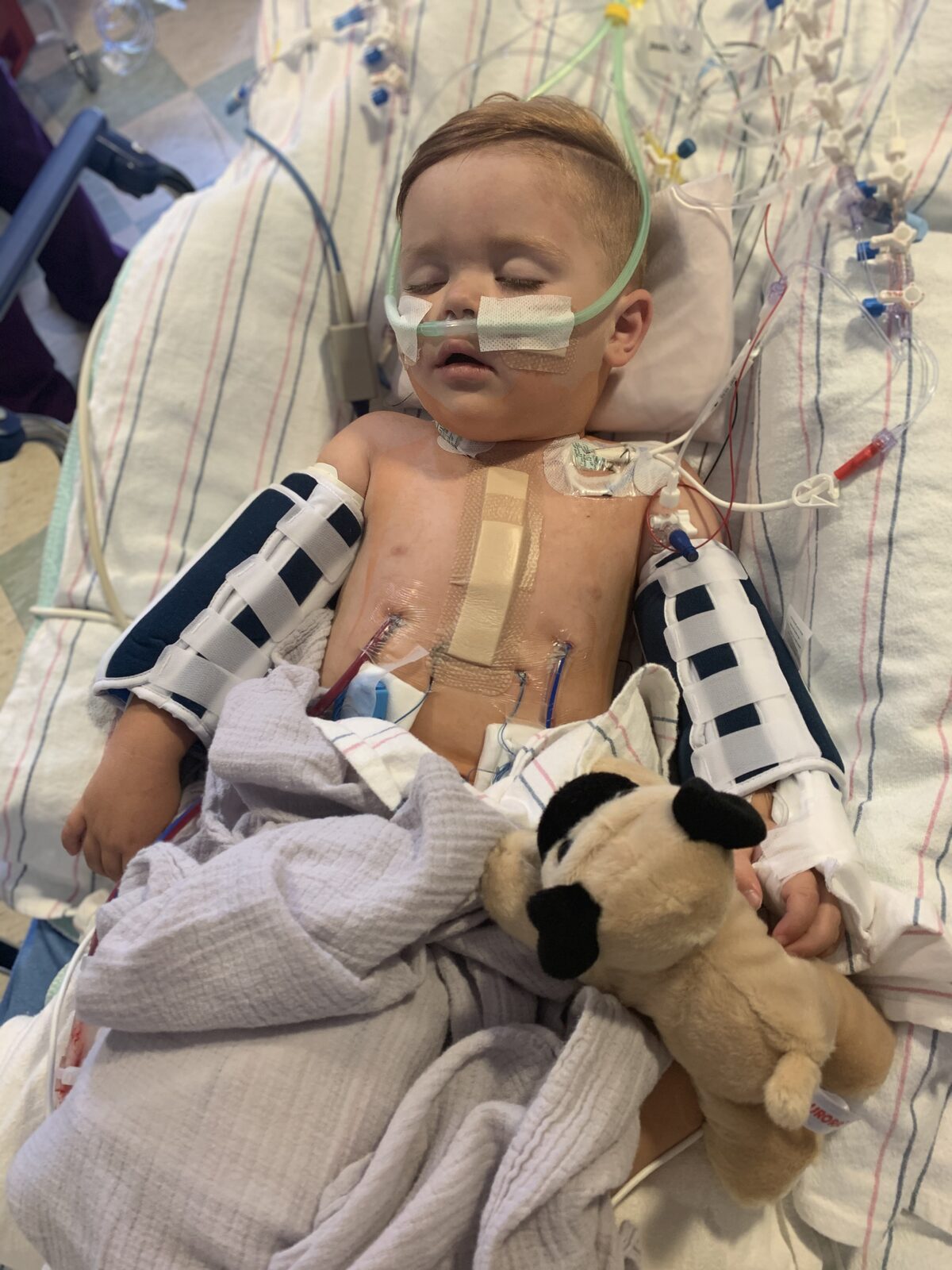 Bronson resting in his hospital bed at Rady Children's while recovering from heart surgery