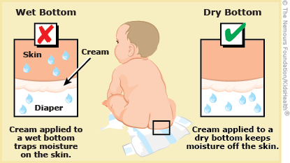 How do you treat a yeast fungal diaper rash on a baby?