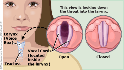 Chronic Hoarseness