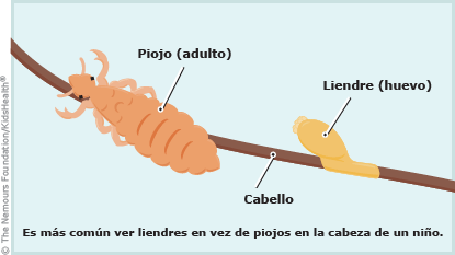 El yodo y el aceite de bardana para los cabellos