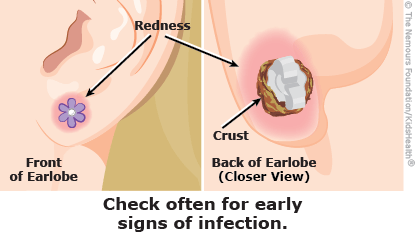Pierced Ears