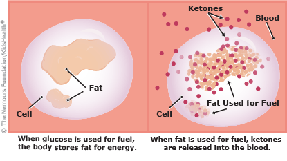 Hyperglycemia And Diabetic Ketoacidosis