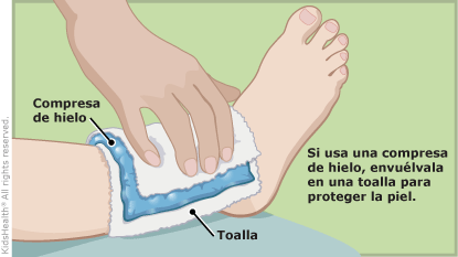Esguinces De Tobillo