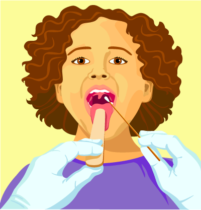 dolor de garganta espalda y fiebre